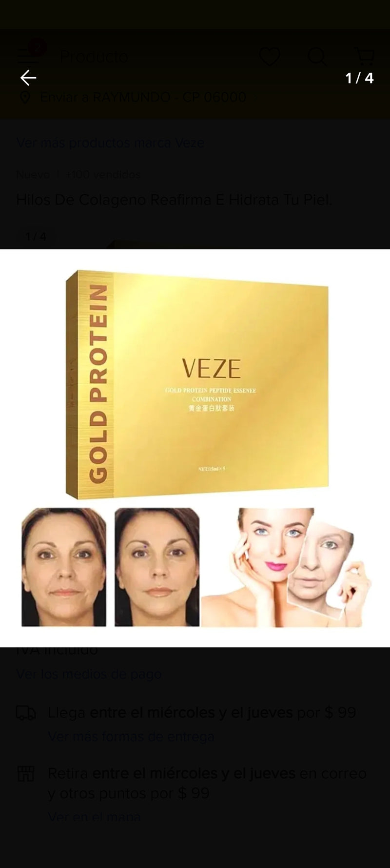 Hilos Tensores - Veze