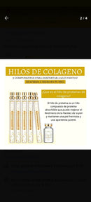 Hilos Tensores - Veze