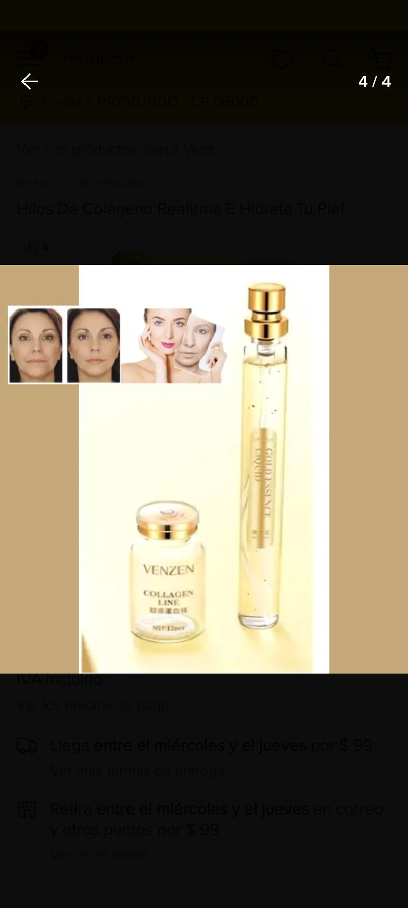 Hilos Tensores - Veze